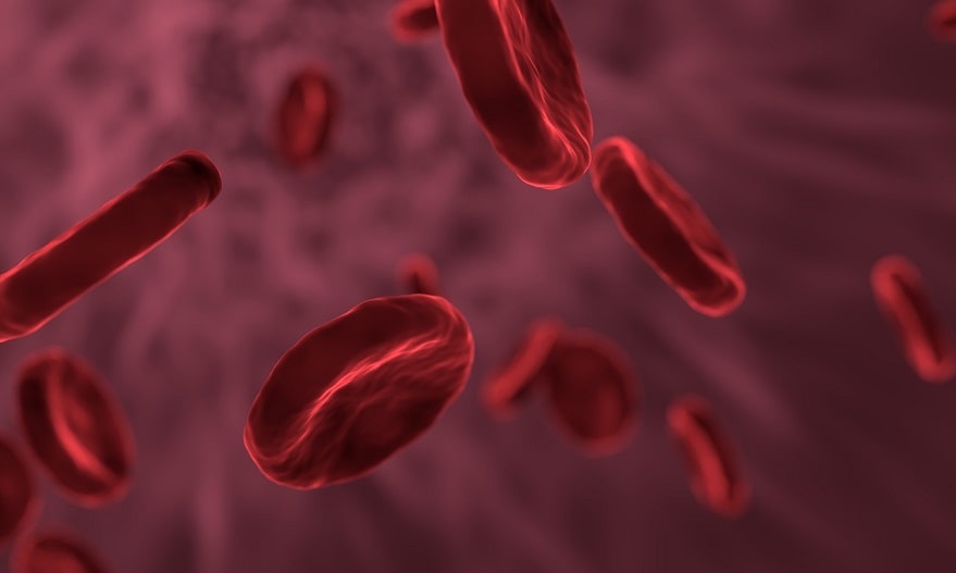anemia, siclemia, anemia feripriva, anemia carenta de fier, anemia carenta de acid folic, anemia carenta de vitamina B12